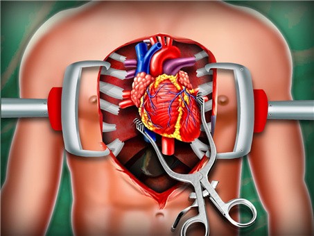模拟心脏手术游戏正式完整版下载
